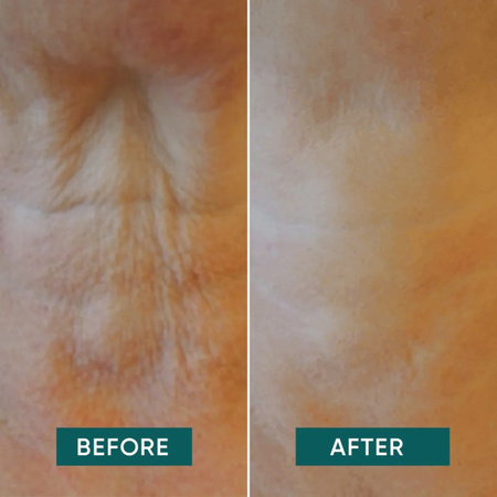 APRICOT wygładzająca maska na szyję "it's neck or nothing"