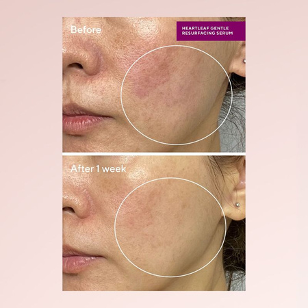 Murad Sensitive skin heartleaf gentle resurf serum - Delikatnie złuszczające serum, 30 ml